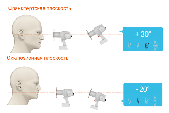 vatech vatech ezray air vatech ezray air portable vatech ezsensor купить  Алматы